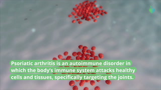 6 Psoriatic Arthritis Symptoms You Shouldn't Ignore