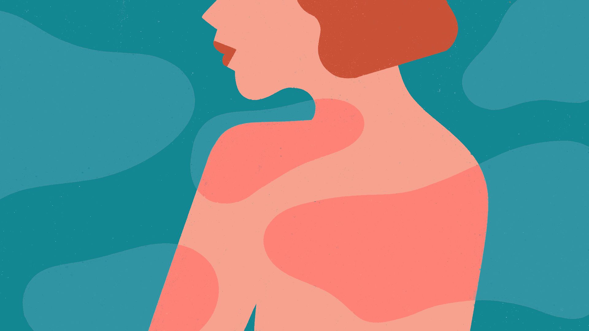 Psoriasis