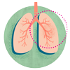 Lung Cancer